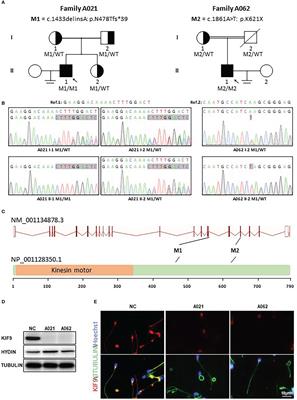 Identification of bi-allelic KIF9 loss-of-function variants contributing to asthenospermia and male infertility in two Chinese families